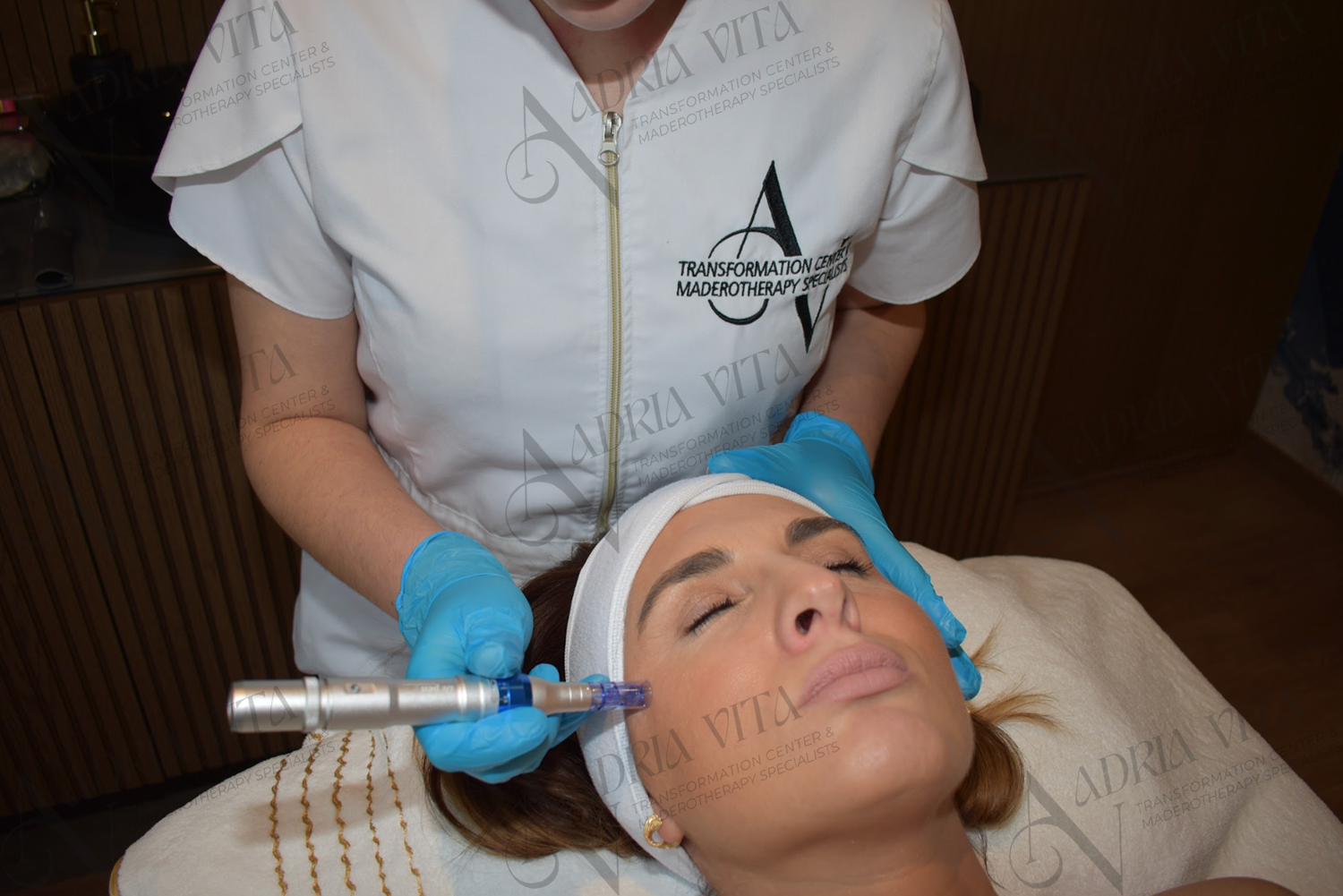 Micro Needling